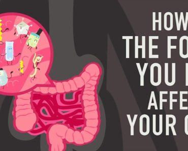 How the food you eat affects your gut