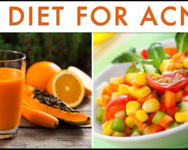 Best Foods for Acne Treatment